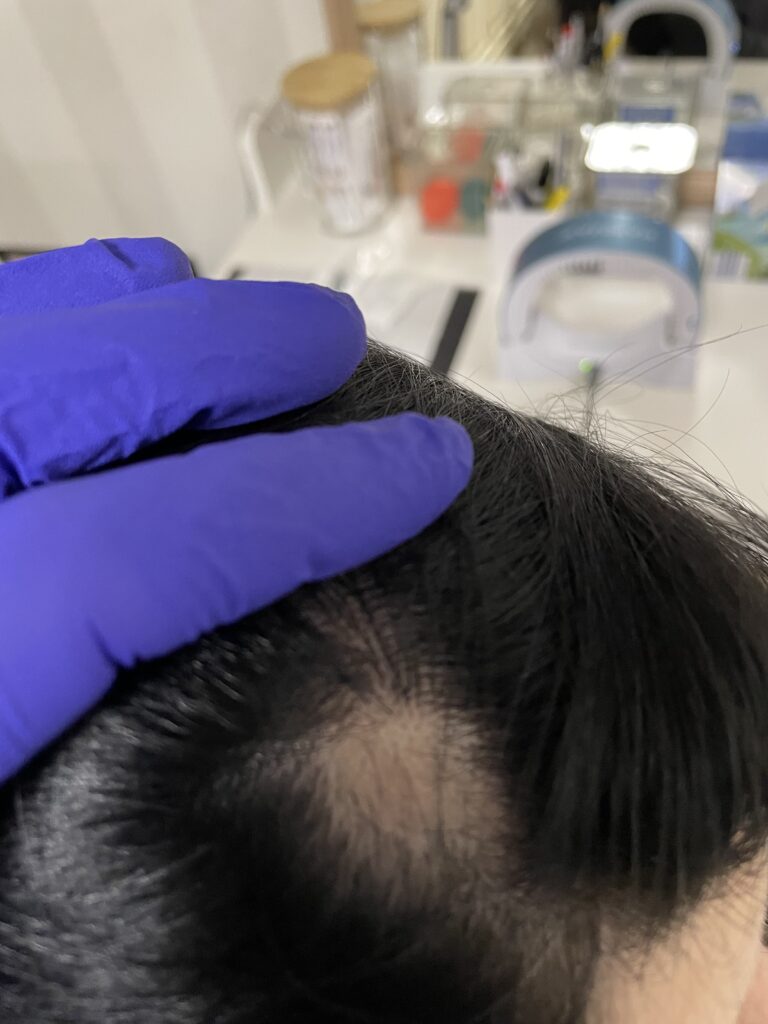Trycholog Bydgoszcz – Milena Kwaśniewska, specjalizuję się w diagnostyce i leczeniu problemów skóry głowy oraz włosów, oferując profesjonalne konsultacje i indywidualnie dobrane terapie. Nowa 15, 85-119 Bydgoszcz https://milena-trycholog.pl