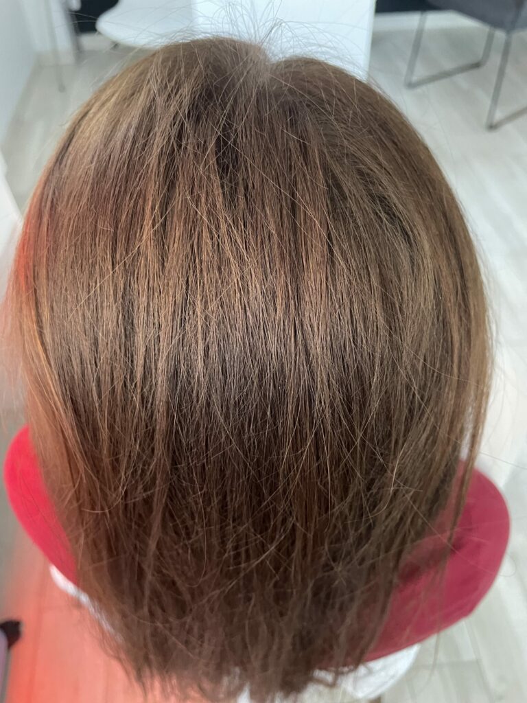 Zdrowa, zadbana skóra głowy to nie tylko kwestia kosmetyki. Milena Trycholog Bydgoszcz