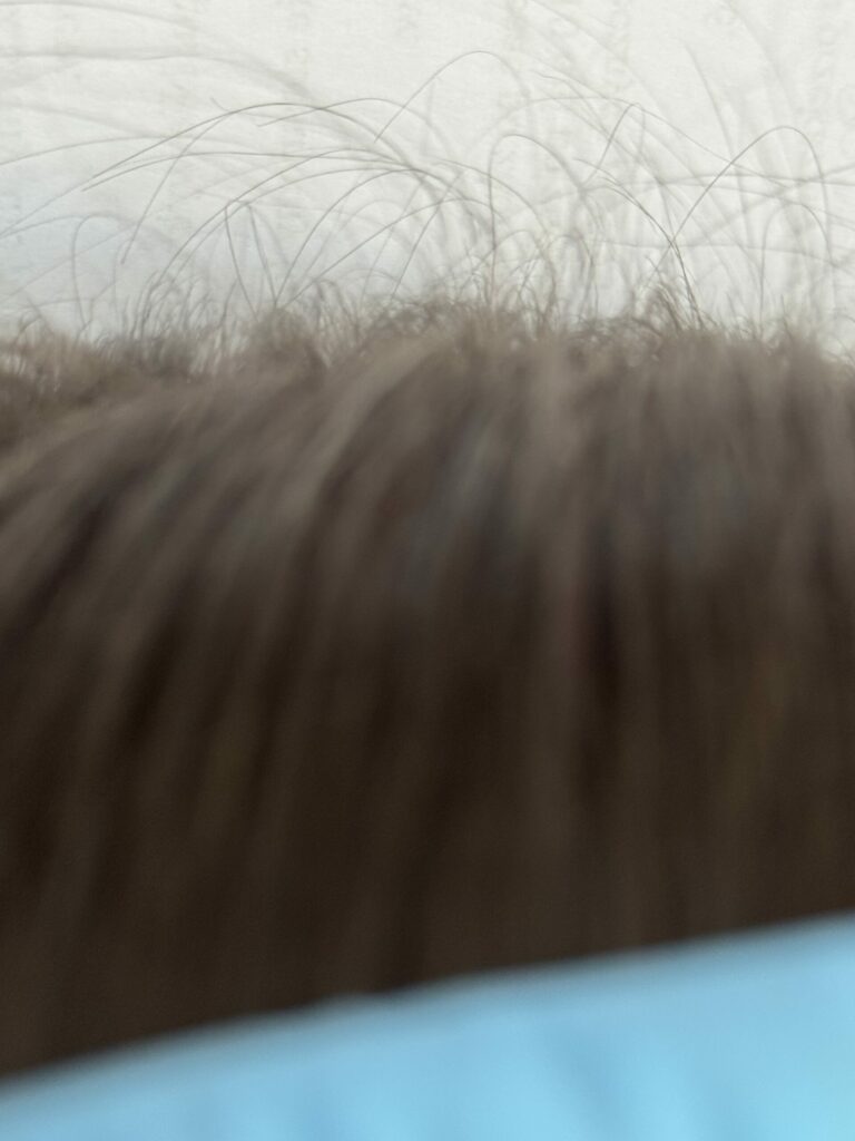 Przypadek z gabinetu: wymagająca skóra i wyzwania zdrowotne - Milena Trycholog Bydgoszcz https://milena-trycholog.pl