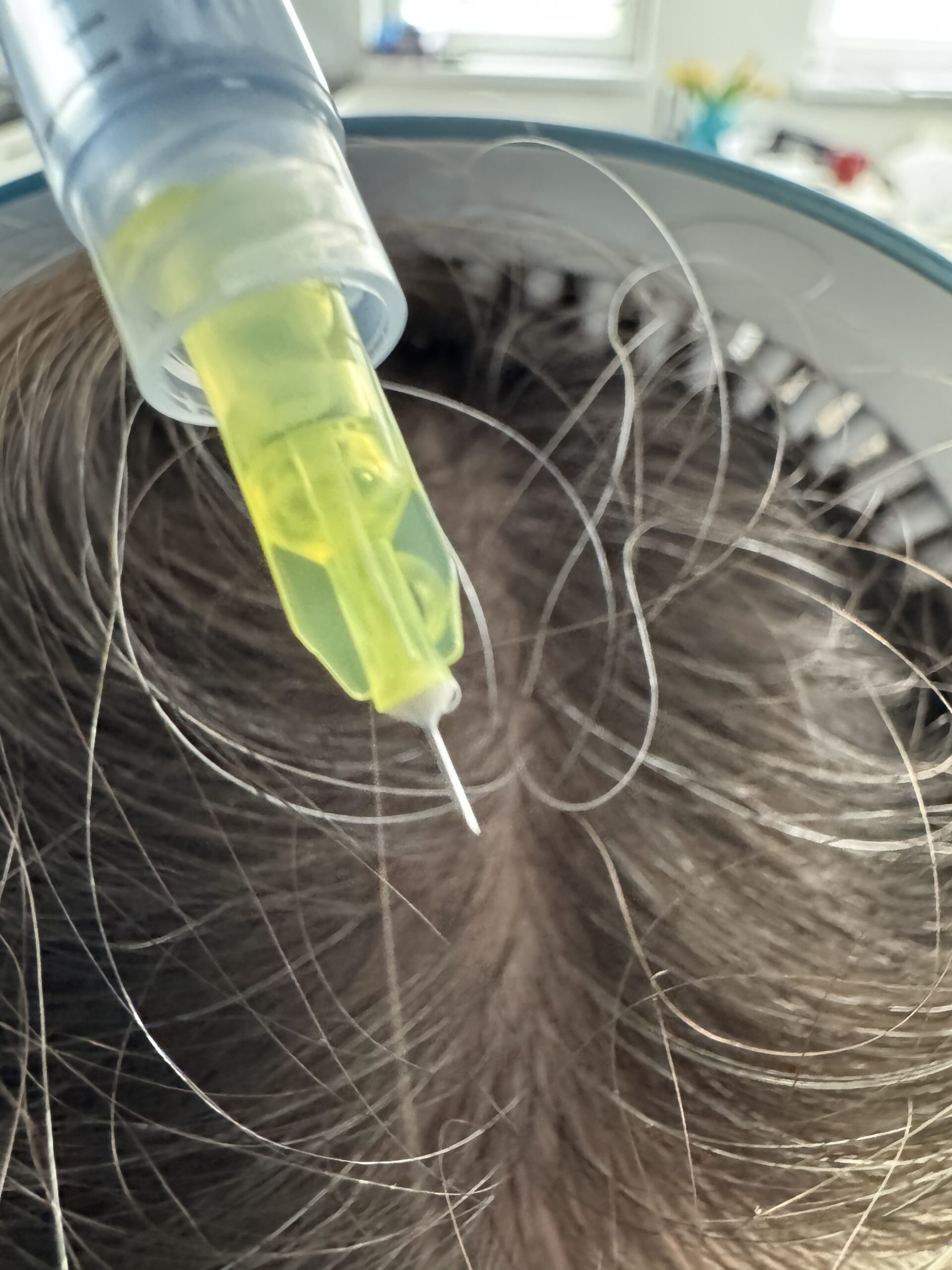 Zniżka na badania Zabiegi trychologiczne Trycholog Bydgoszcz – Milena Kwaśniewska, specjalizuję się w diagnostyce i leczeniu problemów skóry głowy oraz włosów, oferując profesjonalne konsultacje i indywidualnie dobrane terapie. Nowa 15, 85-119 Bydgoszcz https://milena-trycholog.pl CelltiLab Kosmetyki trychologiczne