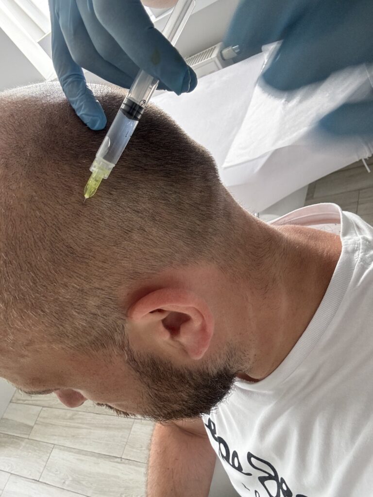 Pytania i odpowiedzi Zabiegi trychologiczne Trycholog Bydgoszcz – Milena Kwaśniewska, specjalizuję się w diagnostyce i leczeniu problemów skóry głowy oraz włosów, oferując profesjonalne konsultacje i indywidualnie dobrane terapie. Nowa 15, 85-119 Bydgoszcz https://milena-trycholog.pl kosmetyki CelltiLab trychologiczne