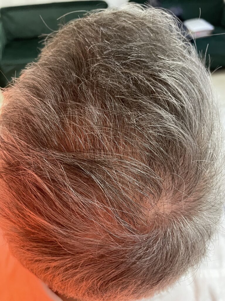 small webp Trycholog Bydgoszcz – Milena Kwaśniewska, specjalizuję się w diagnostyce i leczeniu problemów skóry głowy oraz włosów, oferując profesjonalne konsultacje i indywidualnie dobrane terapie. Nowa 15, 85-119 Bydgoszcz https://milena-trycholog.pl