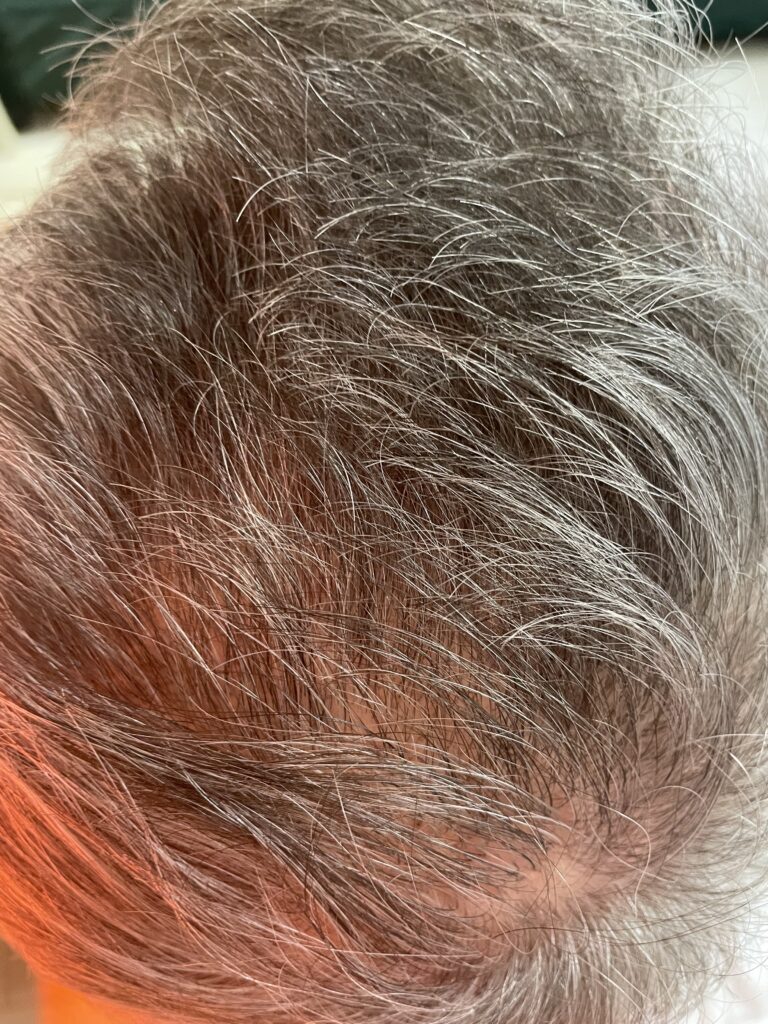 small webp Trycholog Bydgoszcz – Milena Kwaśniewska, specjalizuję się w diagnostyce i leczeniu problemów skóry głowy oraz włosów, oferując profesjonalne konsultacje i indywidualnie dobrane terapie. Nowa 15, 85-119 Bydgoszcz https://milena-trycholog.pl