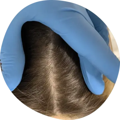 Trycholog Bydgoszcz – Milena Kwaśniewska, Specjalizuję się w diagnostyce i leczeniu problemów skóry głowy oraz włosów, oferując w gabinecie „Trycholog Bydgoszcz Milena” przy ul. Nowej 15 profesjonalne konsultacje oraz indywidualnie dobrane terapie, aby Twoje włosy były zdrowe i piękne. https://milena-trycholog.pl Najlepszy Trycholog w Bydgoszczy