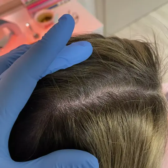 Trycholog Bydgoszcz – Milena Kwaśniewska, Specjalizuję się w diagnostyce i leczeniu problemów skóry głowy oraz włosów, oferując w gabinecie „Trycholog Bydgoszcz Milena” przy ul. Nowej 15 profesjonalne konsultacje oraz indywidualnie dobrane terapie, aby Twoje włosy były zdrowe i piękne. https://milena-trycholog.pl Najlepszy Trycholog w Bydgoszczy, Gabinet trychologiczny, konsultacja