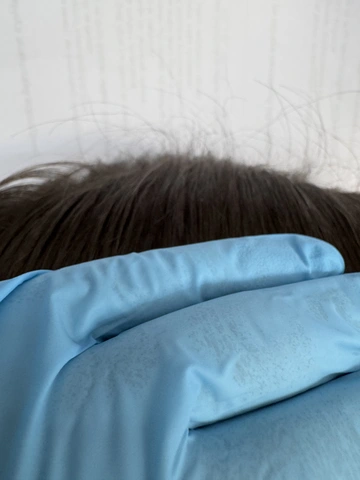 Skuteczny Odrost i Zagęszczanie Włosów Trycholog Bydgoszcz Milena - ul. Nowa 15, 86-119 Bydgoszcz, tel. 571 280 110