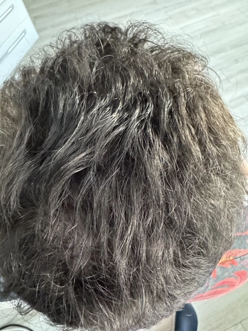 Łysienie u mężczyzn, łysienie androgenowe Trycholog Bydgoszcz Milena - ul. Nowa 15, 86-119 Bydgoszcz, tel. 571 280 110