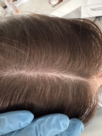 Skuteczny Odrost i Zagęszczanie Włosów Trycholog Bydgoszcz Milena - ul. Nowa 15, 86-119 Bydgoszcz, tel. 571 280 110