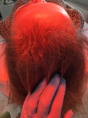 Skuteczny Odrost i Zagęszczanie Włosów Trycholog Bydgoszcz Milena - ul. Nowa 15, 86-119 Bydgoszcz, tel. 571 280 110