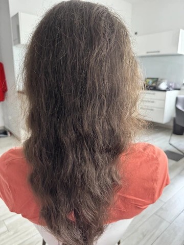 Łysienie u mężczyzn, łysienie androgenowe Trycholog Bydgoszcz Milena - ul. Nowa 15, 86-119 Bydgoszcz, tel. 571 280 110