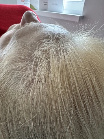 Skuteczny Odrost i Zagęszczanie Włosów Trycholog Bydgoszcz Milena - ul. Nowa 15, 86-119 Bydgoszcz, tel. 571 280 110