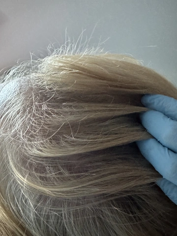 Skuteczny Odrost i Zagęszczanie Włosów Trycholog Bydgoszcz Milena - ul. Nowa 15, 86-119 Bydgoszcz, tel. 571 280 110