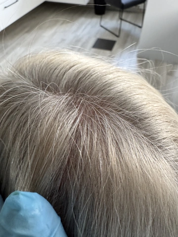 Skuteczny Odrost i Zagęszczanie Włosów Trycholog Bydgoszcz Milena - ul. Nowa 15, 86-119 Bydgoszcz, tel. 571 280 110