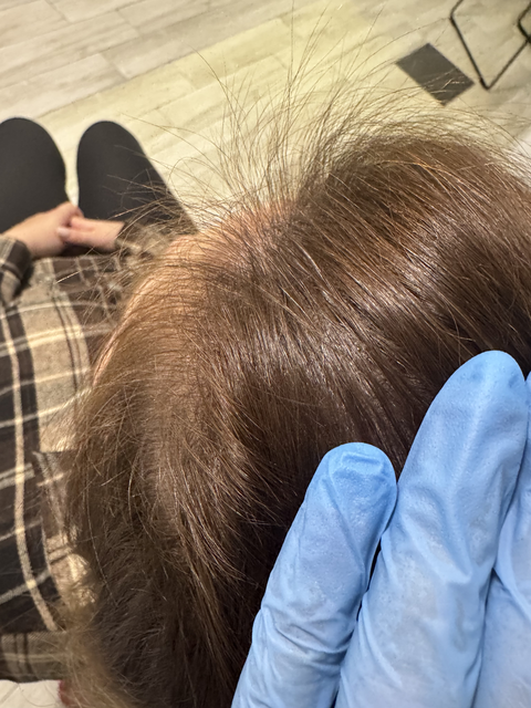 Skuteczny Odrost i Zagęszczanie Włosów Trycholog Bydgoszcz Milena - ul. Nowa 15, 86-119 Bydgoszcz, tel. 571 280 110