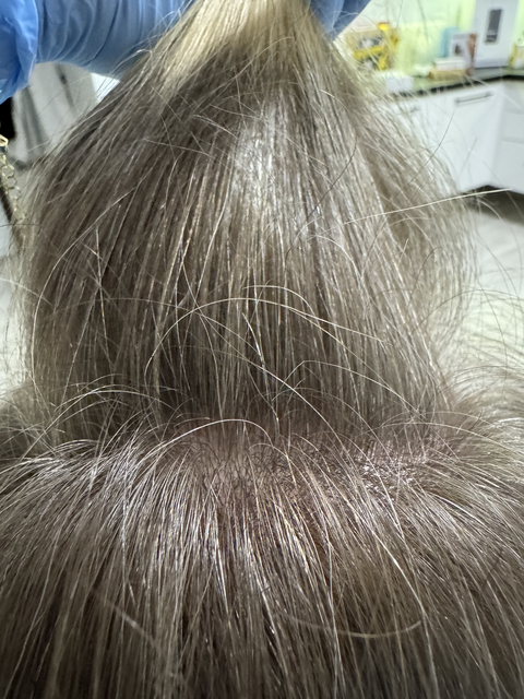 Skuteczny Odrost i Zagęszczanie Włosów Trycholog Bydgoszcz Milena - ul. Nowa 15, 86-119 Bydgoszcz, tel. 571 280 110