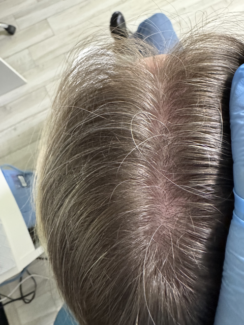 Skuteczny Odrost i Zagęszczanie Włosów Trycholog Bydgoszcz Milena - ul. Nowa 15, 86-119 Bydgoszcz, tel. 571 280 110