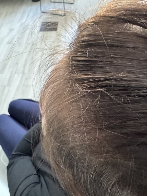 Skuteczny Odrost i Zagęszczanie Włosów Trycholog Bydgoszcz Milena - ul. Nowa 15, 86-119 Bydgoszcz, tel. 571 280 110