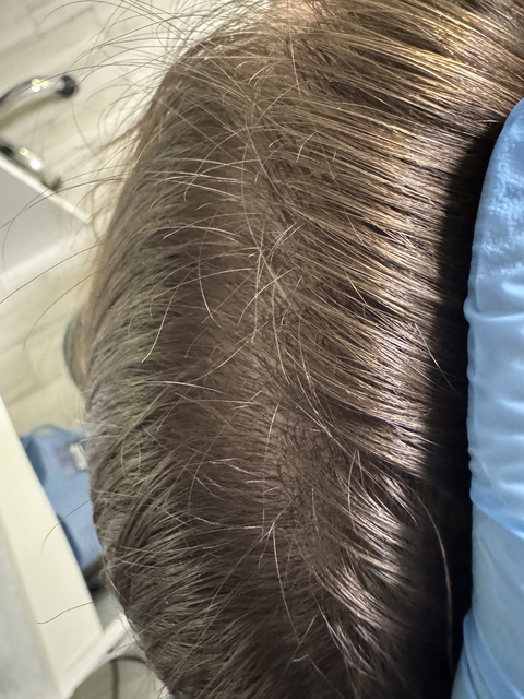 Skuteczny Odrost i Zagęszczanie Włosów Trycholog Bydgoszcz Milena - ul. Nowa 15, 86-119 Bydgoszcz, tel. 571 280 110