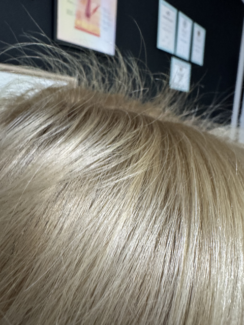 Skuteczny Odrost i Zagęszczanie Włosów Trycholog Bydgoszcz Milena - ul. Nowa 15, 86-119 Bydgoszcz, tel. 571 280 110