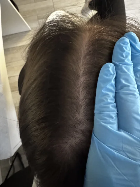 Skuteczny Odrost i Zagęszczanie Włosów Trycholog Bydgoszcz Milena - ul. Nowa 15, 86-119 Bydgoszcz, tel. 571 280 110