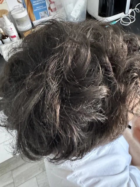 Łysienie u mężczyzn, łysienie androgenowe Trycholog Bydgoszcz Milena - ul. Nowa 15, 86-119 Bydgoszcz, tel. 571 280 110