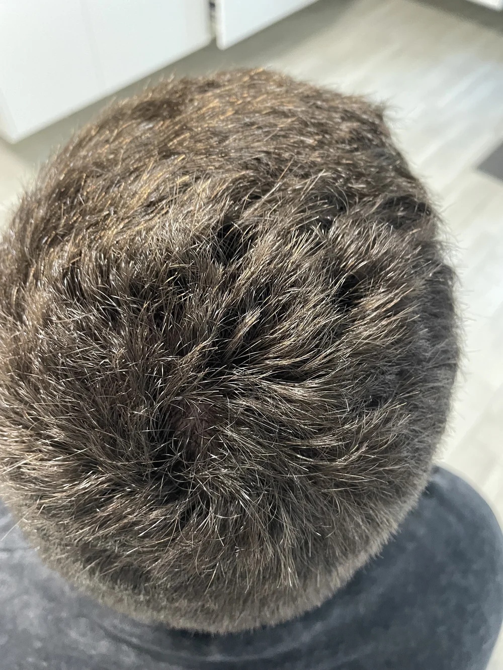 Łysienie u mężczyzn, łysienie androgenowe Trycholog Bydgoszcz Milena - ul. Nowa 15, 86-119 Bydgoszcz, tel. 571 280 110