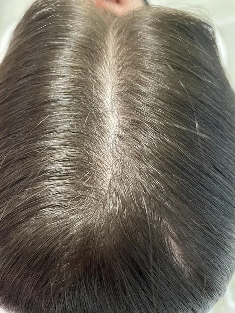 Skuteczny Odrost i Zagęszczanie Włosów Trycholog Bydgoszcz Milena - ul. Nowa 15, 86-119 Bydgoszcz, tel. 571 280 110