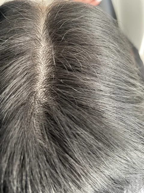 Skuteczny Odrost i Zagęszczanie Włosów Trycholog Bydgoszcz Milena - ul. Nowa 15, 86-119 Bydgoszcz, tel. 571 280 110